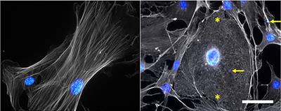 Experimental Models to Study the Pathogenesis of Malaria-Associated Acute Respiratory Distress Syndrome